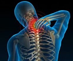 mugurkaula kakla daļas osteohondroze